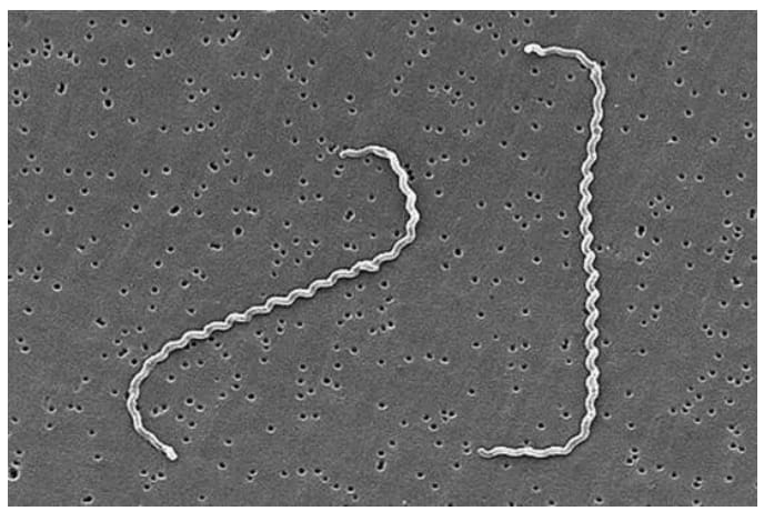 Exploration of Leptospira