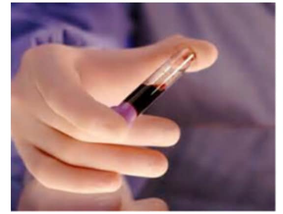 Diagnostic Methods