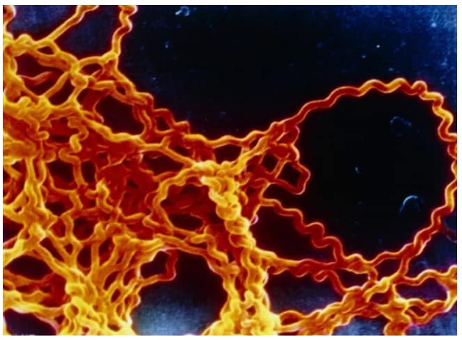 Leptospira