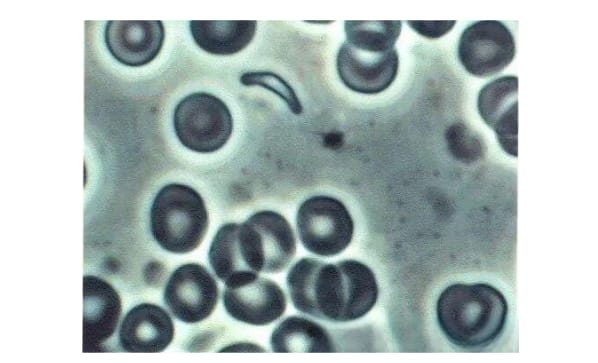 Toxoplasma gondii