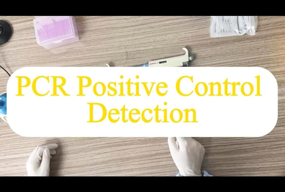 PCR Positive Control Detection